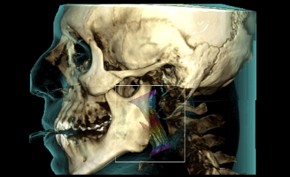 Airway 3D assessment