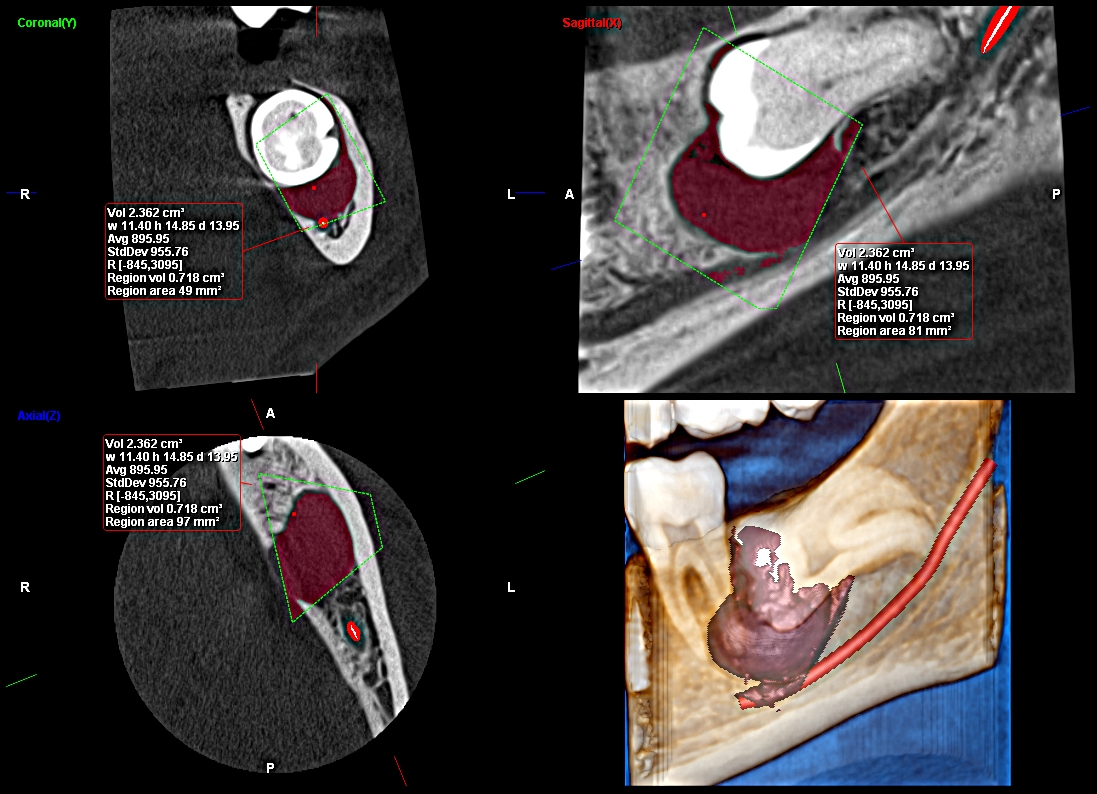 Regional CBCT volume assessment