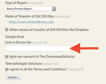 other-means-of-transfer