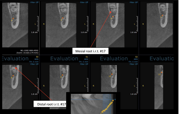 Screen Shot 2017-04-11 at 3.00.48 PM
