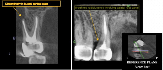 Screen Shot 2017-04-11 at 3.09.56 PM