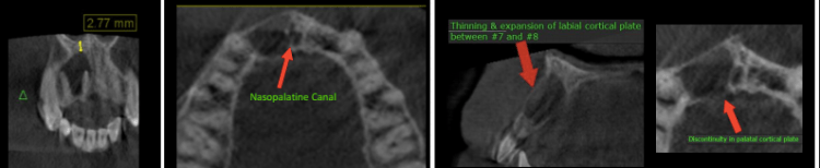 Screen Shot 2017-04-11 at 4.17.33 PM