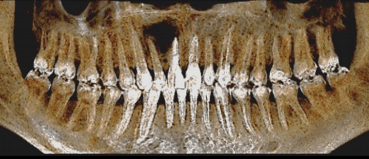 Screen Shot 2017-04-11 at 4.20.10 PM