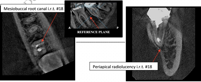 Screen Shot 2017-04-11 at 4.22.26 PM