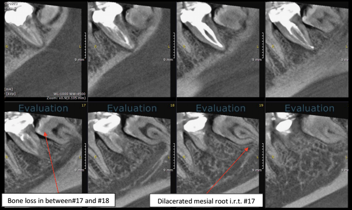 Screen Shot 2017-04-11 at 4.30.34 PM