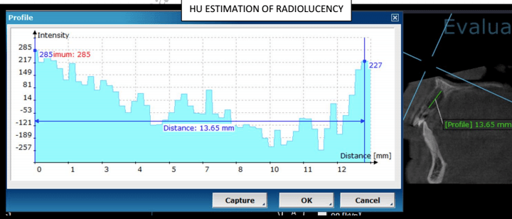 Screen Shot 2017-04-11 at 4.40.46 PM